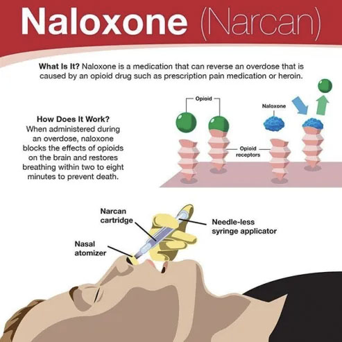 Naloxone (Narcan) - what is it & how does it work